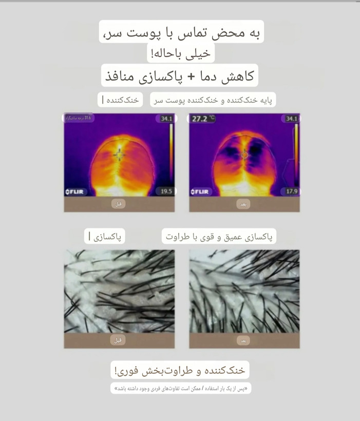تونیک کافئین ضد ریزش سی پی وان